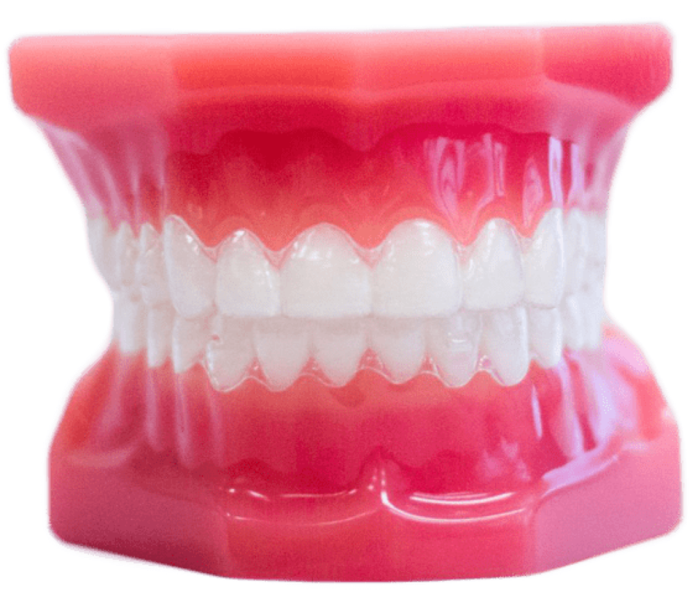 invisalign aligners on plastic model