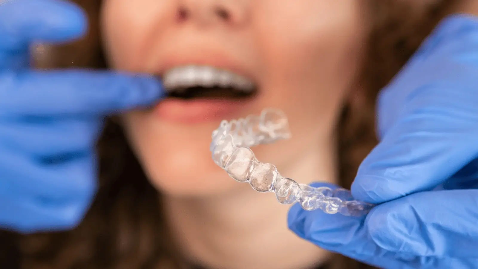 Manage Invisalign Pain