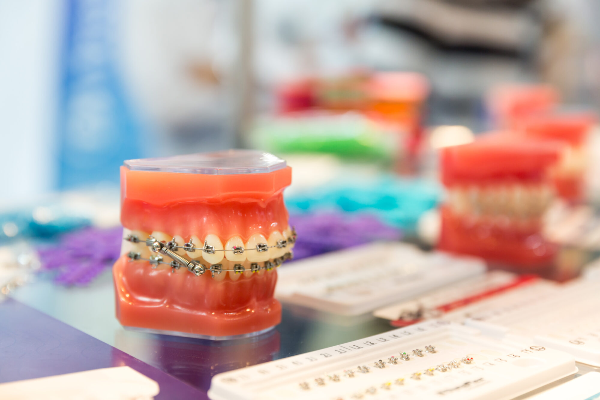 Orthodontic Treatment Modesto