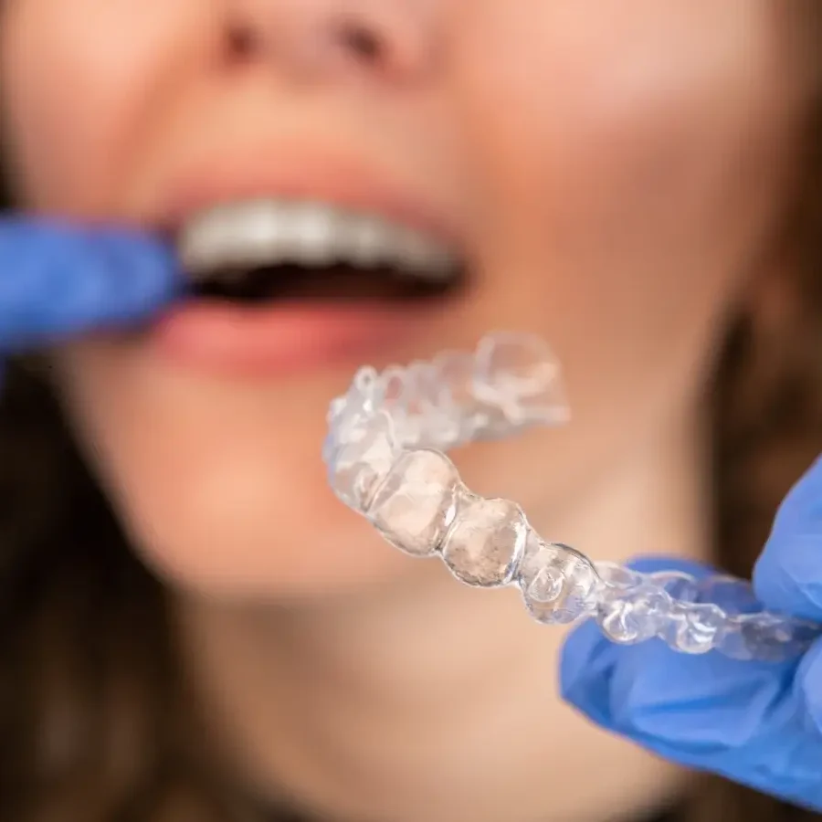 insurance cover clear aligners